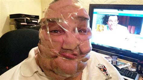 Scotch Tape Selfies Newest Trend Of Distorting Faces With