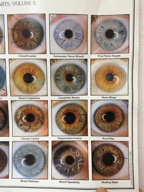 A Iris Signs Chart 3 Iridology Eye Color Chart Rare Eye Colors