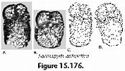 Afbeeldingsresultaten voor "botryocyrtis Scutum". Grootte: 177 x 101. Bron: www.uv.es