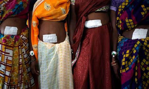 will the closure of india s sterilisation camps end botched operations