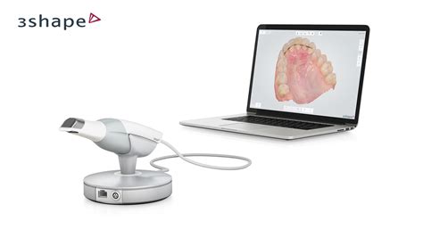trios    digital impression scanning  rs unit dental scanner id