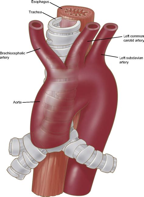 figure   anatomy   thoracic aorta    branches semantic scholar