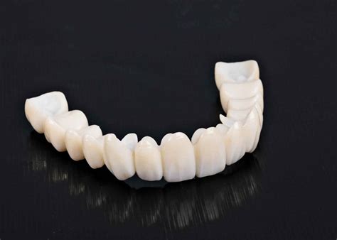 quality zirconia crown  india cosmodent india