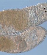 Afbeeldingsresultaten voor Dolichomacrostomidae. Grootte: 158 x 185. Bron: alchetron.com