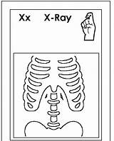 Coloring Letter Ray Pages Asl Alphabet Preschool Language Sign Kids Worksheets Drawing Cards Flash Printable Fish Color Malcolm Fun Handwriting sketch template