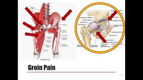 hip joint pain anatomy