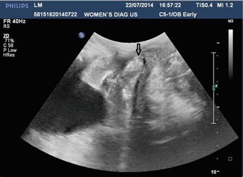 Practical Application Of Ultrasound In The Assessment Of Pelvic Organ