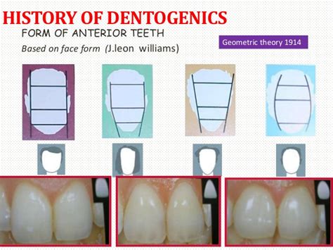 esthetics in complete dentures dentogenic concept