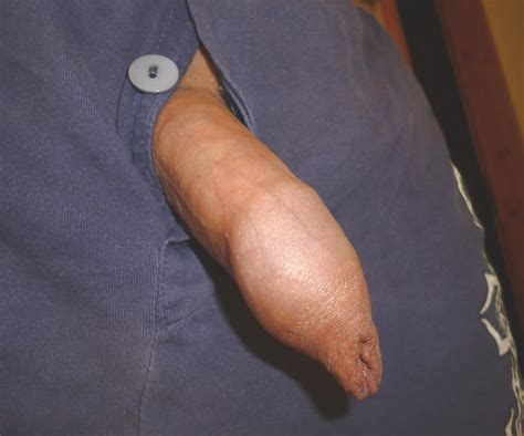 very small dick with long foreskin 56 pics xhamster