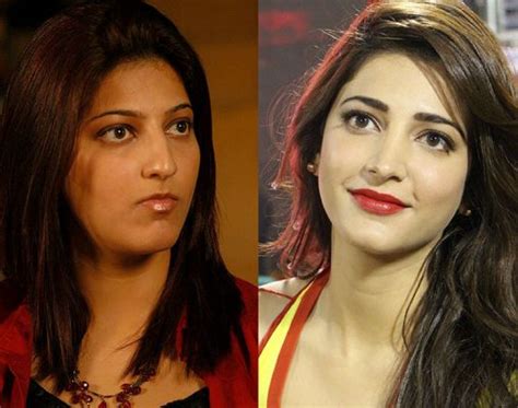 Shruti Hassan Before Plastic Surgery Shruti Haasan S