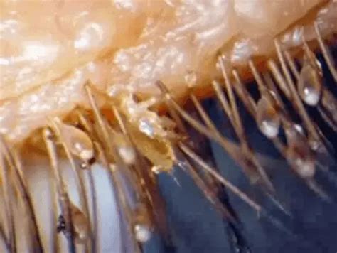 eyelash mites  symptoms  humans pictures mascara eyebrow