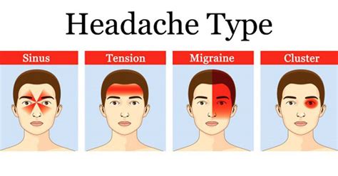 this is how headaches reveal what is wrong with your health the