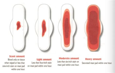 Exam 4 Vaginal Bleeding And Ob Gyn Emergencies Flashcards Quizlet