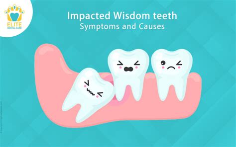 impacted wisdom teeth symptoms and causes elite dental care