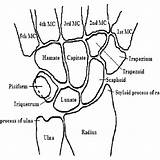 Metacarpal Wrist Osseus Representation Mc sketch template