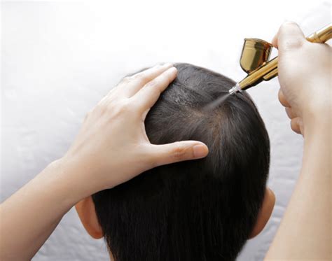 scalp corrective treatment   philippines svenson
