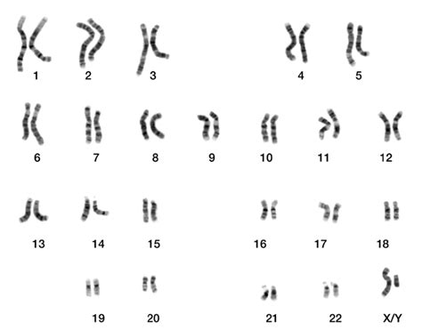 genetik zellkern chromosomen karyogramm