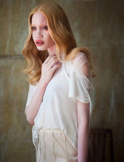 Albino Model Diandra Forrest Porn Videos Newest Albino With Blonde