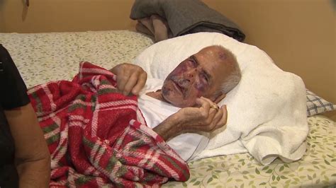 92 year old man beaten with brick attacked by 5 people