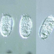 Afbeeldingsresultaten voor "Protocystis Bicuspid". Grootte: 185 x 185. Bron: protist.i.hosei.ac.jp