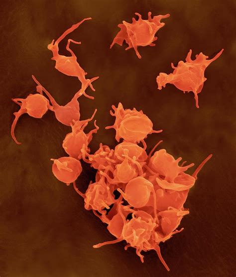 activated platelets  photograph  dennis kunkel microscopyscience