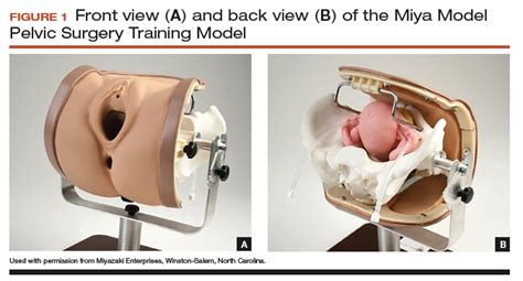 Whats New In Simulation Training For Hysterectomy Mdedge Obgyn