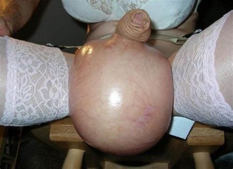 saline balls off the net fetish porn pic