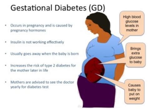 Gestational Diabetes – Abda