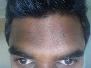 correct dark forehead doctor answers tips