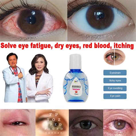 Eye Drops For Cataract Original 15ml Eyedrops For Tired Eyes Dry Sore