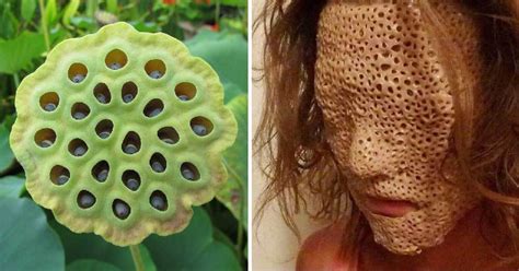 creepy and disgusting holes that will trigger your