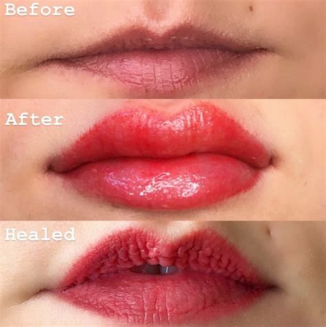 How To Remove Lip Blush Tattoo Christensen Welaidene