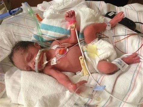 arizona woman dies after giving birth to quadruplets