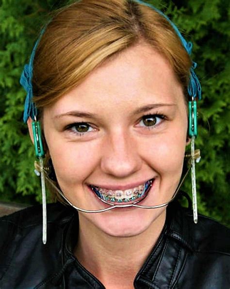 pin by john beeson on girls in headgear braces girls headgear hair my