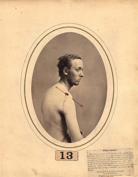 dr reed bontecous stunning pictures  wounded civil war veterans
