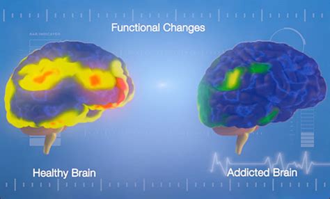 understanding addiction reward and pleasure in the brain inspire malibu