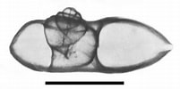 Afbeeldingsresultaten voor Atlanta echinogyra Anatomie. Grootte: 201 x 100. Bron: tolweb.org