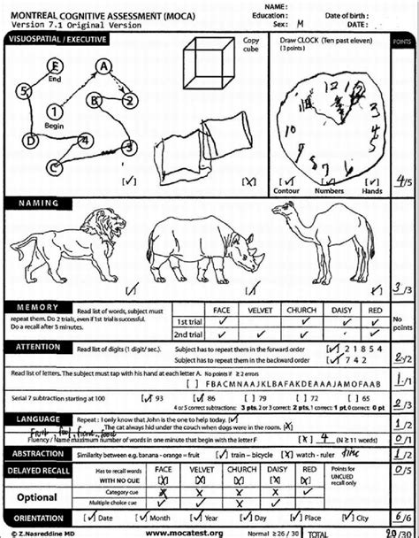 the performance of this patient on the montreal cognitive assessment