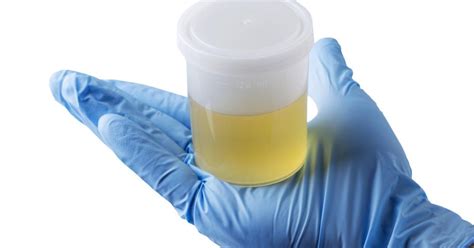 what does cloudy urine mean