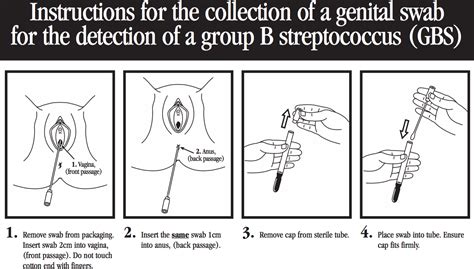 Streptococcus Agalactiae Streptococcus Group B