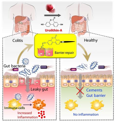 metabolite produced  gut microbiota  pomegranates reduces inflammatory bowel disease