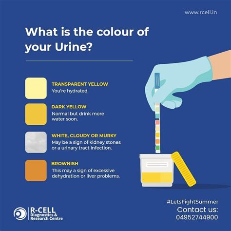 normal urine color ranges  pale yellow  deep amber normal urine