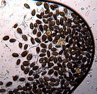 Afbeeldingsresultaten voor "ostreopsis Labens". Grootte: 190 x 185. Bron: www.la-croix.com