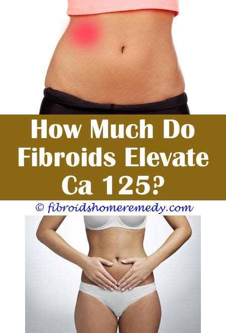 Uterine Fibroids Treatment Uterine Fibroids Treatment Fibroids