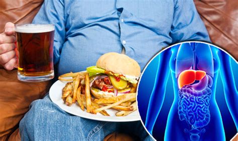 Fatty Liver Disease Caused By Obesity Could Be Reversed With Drug