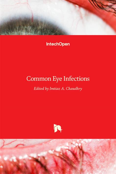 Common Eye Infections Intechopen