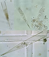 Afbeeldingsresultaten voor "Xystonellopsis Ornata". Grootte: 159 x 185. Bron: protist.i.hosei.ac.jp