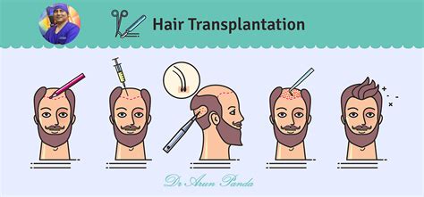 hair transplant performed  navi mumbai