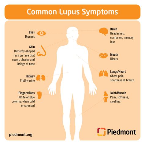 lupus  symptoms  treatment information piedmont healthcare