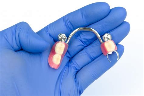 herausnehmbare zahnprothesen individuell gefertigt